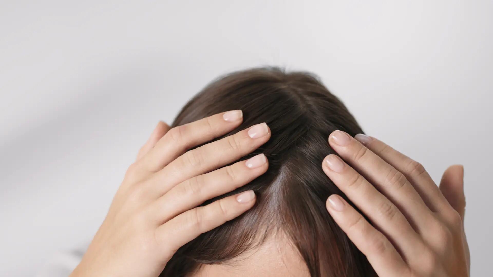 Fatores que influenciam a alopecia androgenética